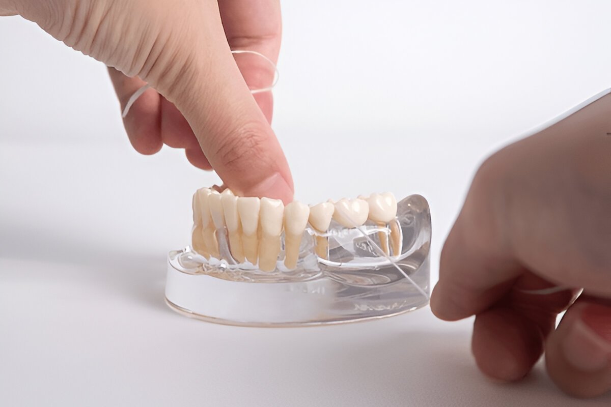 dental-bridges-saskatoon dental bridges saskatoon