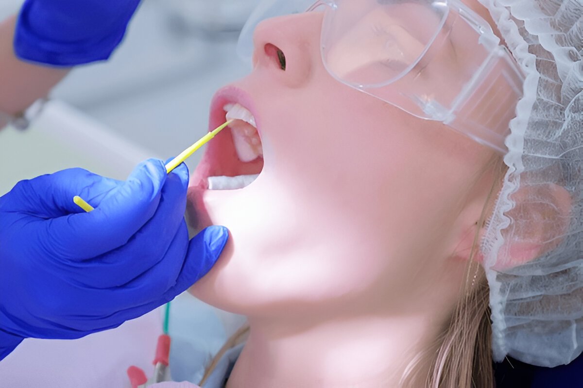 sealants-and-fluoride-treatment-in-saskatoon dental sealants and fluoride treatment saskatoon