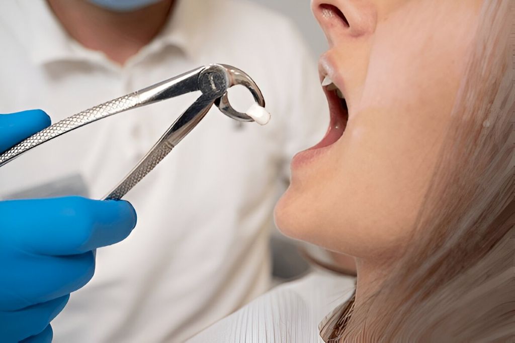 tooth-extractions-saskatoon tooth extractions saskatoon