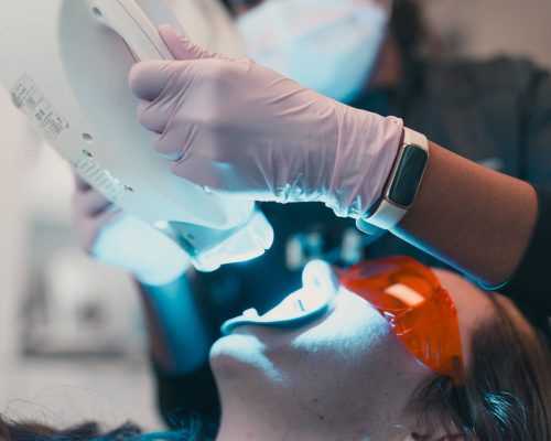 teeth whitening saskatoon